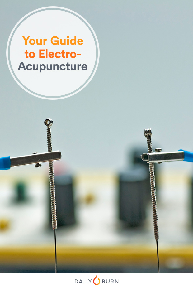 Everything You Need to Know About Electroacupuncture